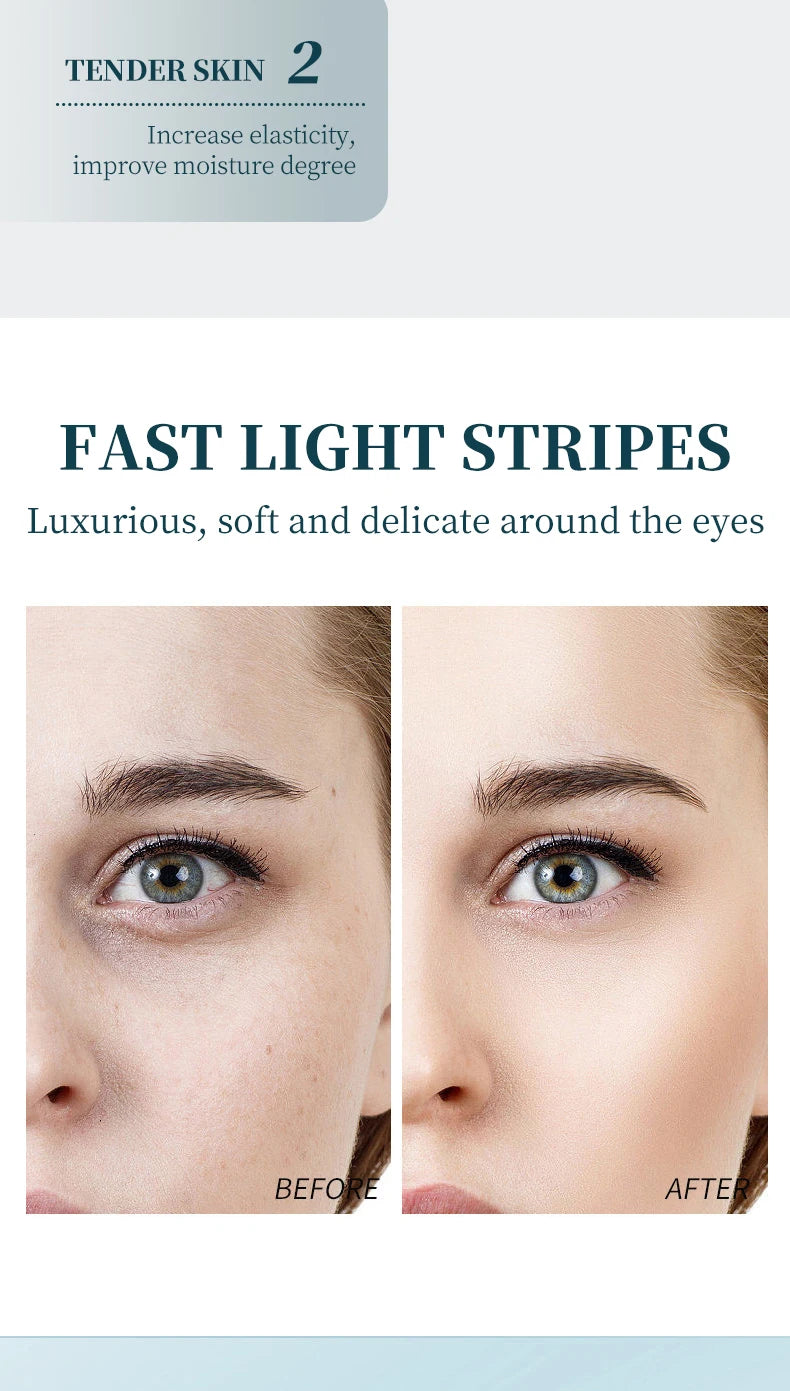 Ocheal Eye Cream Roller – Dark Circle