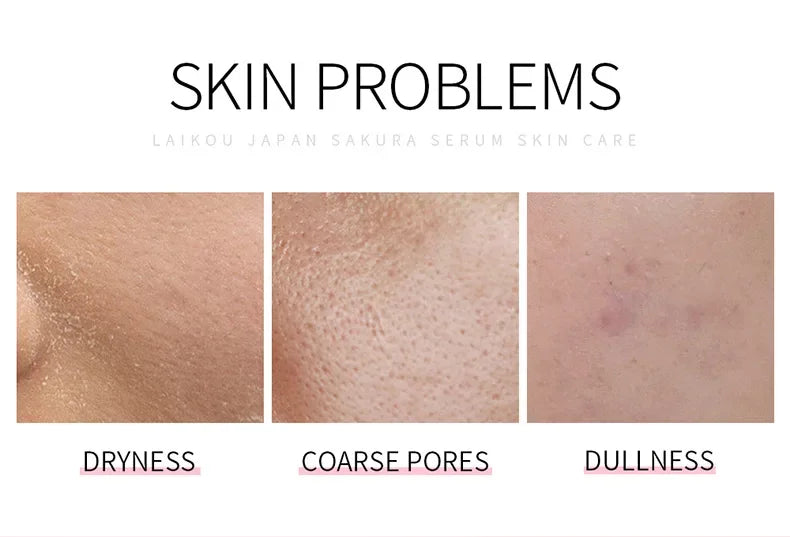 LAIKOU Cherry Blossom.