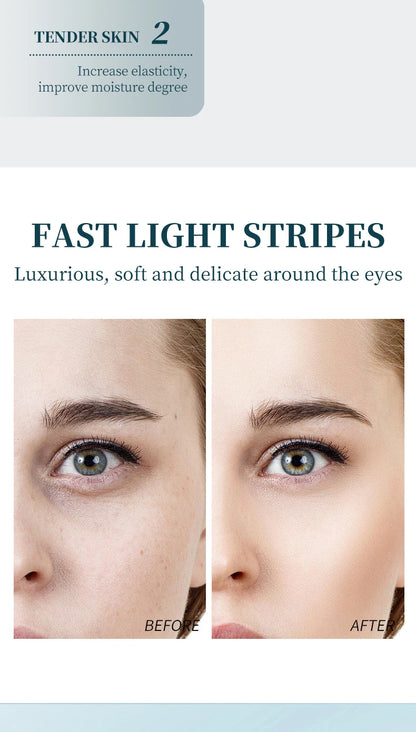 Ocheal Eye Cream Roller – Dark Circle