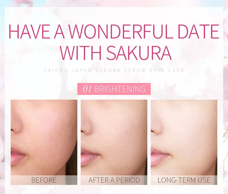 LAIKOU Cherry Blossom.